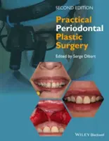 Praktická parodontálna plastická chirurgia - Practical Periodontal Plastic Surgery