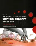 Tradičná čínska medicína Baňková terapia - Traditional Chinese Medicine Cupping Therapy
