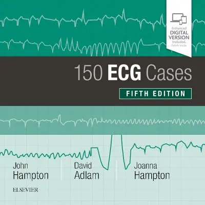 150 prípadov EKG - 150 ECG Cases