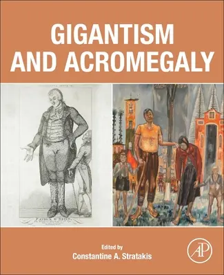 Gigantizmus a akromegália - Gigantism and Acromegaly
