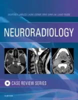 Neurorádiologické zobrazovanie Prípadový prehľad - Neuroradiology Imaging Case Review