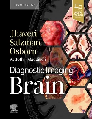Diagnostické zobrazovanie: Mozog - Diagnostic Imaging: Brain