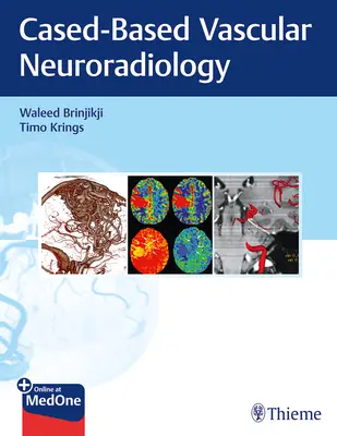 Zobrazovanie pri neurovaskulárnych ochoreniach: Prístup založený na konkrétnych prípadoch - Imaging in Neurovascular Disease: A Case-Based Approach