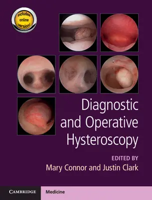 Diagnostická a operačná hysteroskopia - Diagnostic and Operative Hysteroscopy