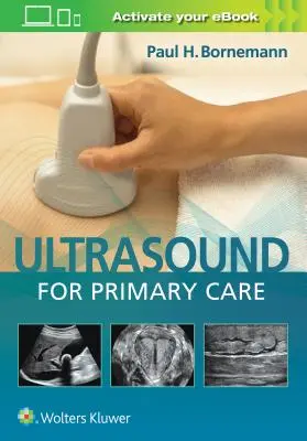 Ultrazvuk pre primárnu starostlivosť [s elektronickou knihou] - Ultrasound for Primary Care [With eBook]