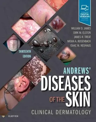 Andrewsove choroby kože: Klinická dermatológia - Andrews' Diseases of the Skin: Clinical Dermatology