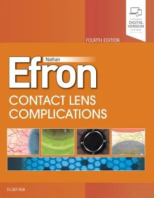 Komplikácie s kontaktnými šošovkami - Contact Lens Complications