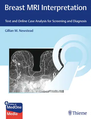 Interpretácia magnetickej rezonancie prsníkov: Text a online analýza prípadov na skríning a diagnostiku - Breast MRI Interpretation: Text and Online Case Analysis for Screening and Diagnosis