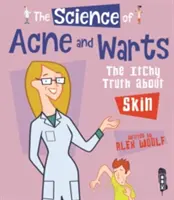 Veda o akné a bradaviciach - svrbivá pravda o pokožke - Science Of Acne & Warts - The Itchy Truth About Skin