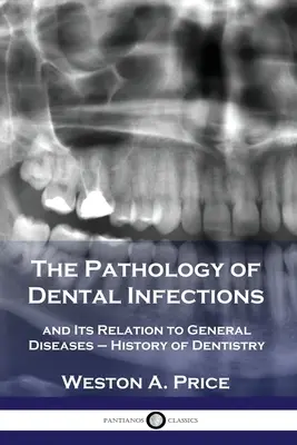 Patológia zubných infekcií a jej vzťah k všeobecným chorobám - Dejiny zubného lekárstva - The Pathology of Dental Infections: and Its Relation to General Diseases - History of Dentistry