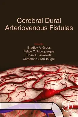 Cerebrálne durálne arteriovenózne fistuly - Cerebral Dural Arteriovenous Fistulas