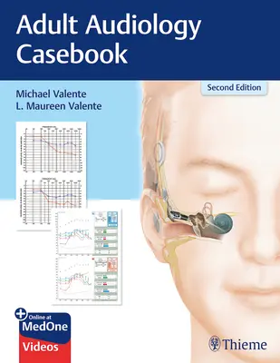 Kazuistika audiológie dospelých - Adult Audiology Casebook