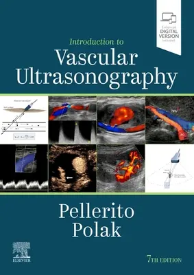 Úvod do cievnej ultrasonografie - Introduction to Vascular Ultrasonography