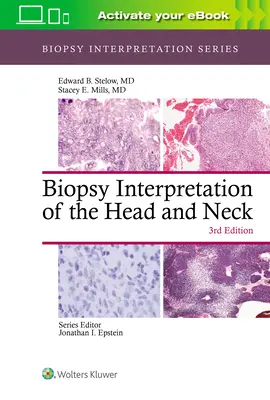 Interpretácia biopsie hlavy a krku - Biopsy Interpretation of the Head and Neck