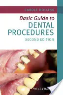 Základný sprievodca zubnými postupmi - Basic Guide to Dental Procedures
