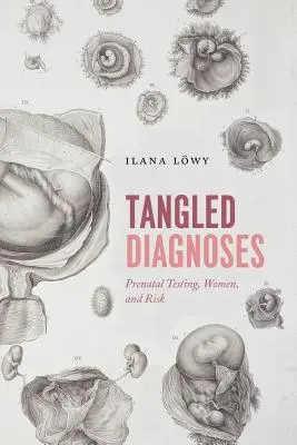 Zamotané diagnózy: Prenatálne testovanie, ženy a riziko - Tangled Diagnoses: Prenatal Testing, Women, and Risk