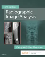 Rádiografická analýza obrazu - Radiographic Image Analysis