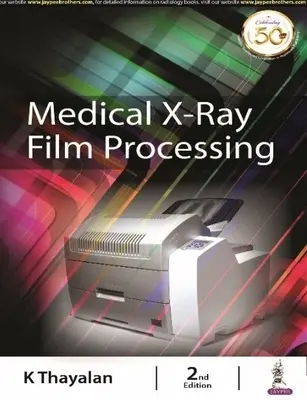 Spracovanie lekárskych röntgenových filmov - Medical X-ray Film Processing