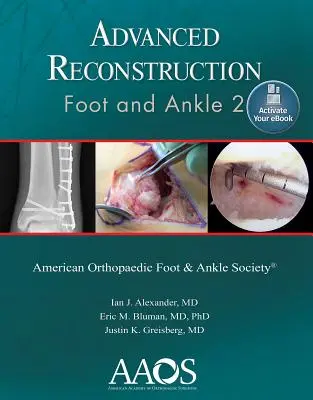 Pokročilá rekonštrukcia: Noha a členok 2: print + eBook - Advanced Reconstruction: Foot and Ankle 2: Print + eBook