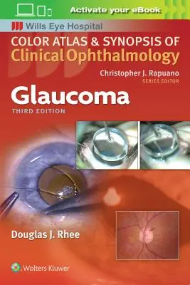 Glaukóm - Glaucoma