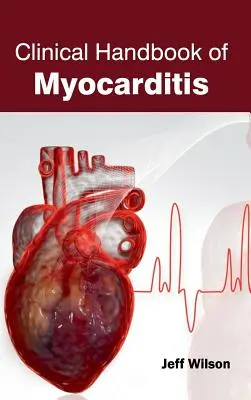 Klinická príručka myokarditídy - Clinical Handbook of Myocarditis