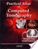 Praktický atlas počítačovej tomografie - Practical Atlas of Computed Tomography