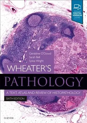Wheaterova patológia: A Text, Atlas and Review of Histopathology - Wheater's Pathology: A Text, Atlas and Review of Histopathology