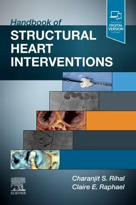 Príručka štrukturálnych zásahov do srdca - Handbook of Structural Heart Interventions