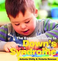 Downov syndróm: Základná príručka - Down's Syndrome: The essential Guide
