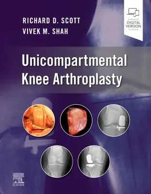 Unikompartmentálna artroplastika kolena - Unicompartmental Knee Arthroplasty