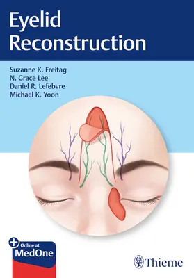 Rekonštrukcia očných viečok - Eyelid Reconstruction