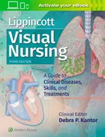 Vizuálne ošetrovateľstvo Lippincott: A Guide to Clinical Diseases, Skills, and Treatments - Lippincott Visual Nursing: A Guide to Clinical Diseases, Skills, and Treatments