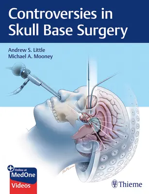 Kontroverzie v chirurgii lebky - Controversies in Skull Base Surgery