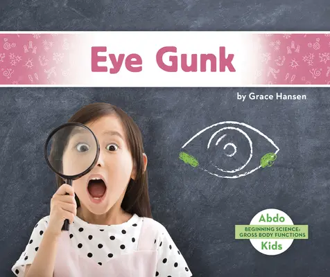 Očné výkaly - Eye Gunk