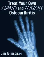 Liečba osteoartrózy ruky a palca - Treat Your Own Hand and Thumb Osteoarthritis