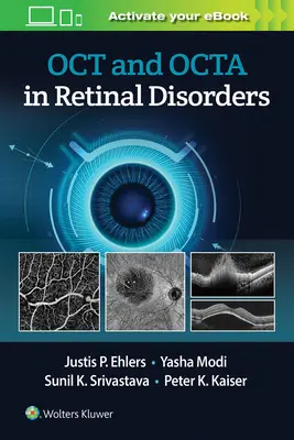Oct a Octa pri poruchách sietnice - Oct and Octa in Retinal Disorders