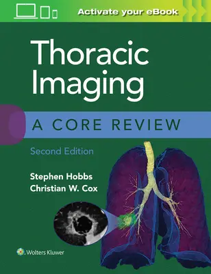 Zobrazovanie hrudníka: Základný prehľad - Thoracic Imaging: A Core Review