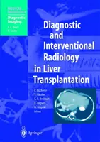 Diagnostická a intervenčná rádiológia pri transplantácii pečene - Diagnostic and Interventional Radiology in Liver Transplantation