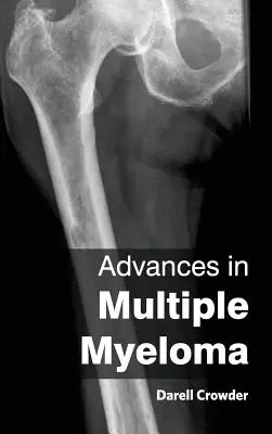 Pokroky v liečbe mnohopočetného myelómu - Advances in Multiple Myeloma