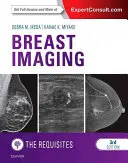 Zobrazovanie prsníkov: Bádanie: nové poznatky o bádaní: základné informácie - Breast Imaging: The Requisites