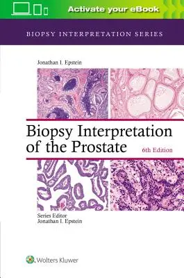 Interpretácia biopsie prostaty - Biopsy Interpretation of the Prostate