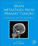 Mozgové metastázy z primárnych nádorov, 2. diel: Epidemiológia, biológia a terapia - Brain Metastases from Primary Tumors, Volume 2: Epidemiology, Biology, and Therapy