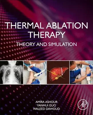 Terapia tepelnou abláciou: Teória a simulácia - Thermal Ablation Therapy: Theory and Simulation