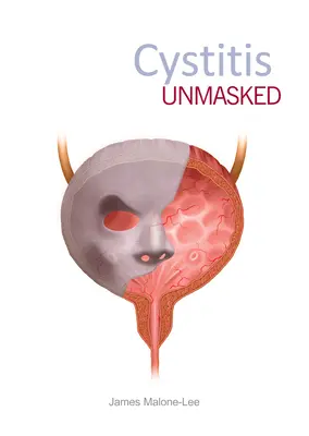 Cystitída odhalená - Cystitis Unmasked