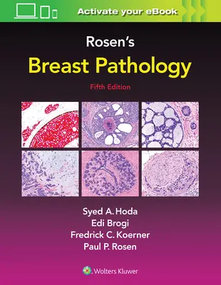 Rosenova patológia prsníka - Rosen's Breast Pathology