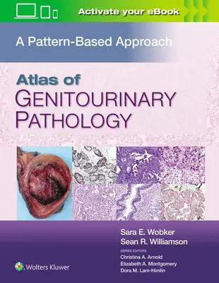 Atlas genitourinárnej patológie: A Pattern Based Approach (Prístup založený na vzoroch) - Atlas of Genitourinary Pathology: A Pattern Based Approach