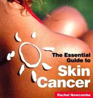 Rakovina kože: Základný sprievodca - Skin Cancer: The Essential Guide