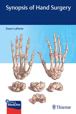 Synopsa chirurgie ruky - Synopsis of Hand Surgery