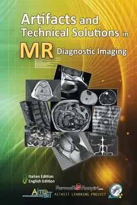 Artefakty a technické riešenia pri diagnostickom zobrazovaní pomocou magnetickej rezonancie - Artifacts and Technical Solutions in MR Diagnostic Imaging