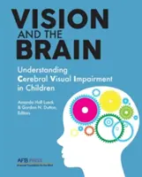 Zrak a mozog: Pochopenie mozgovej poruchy zraku u detí - Vision and the Brain: Understanding Cerebral Visual Impairment in Children